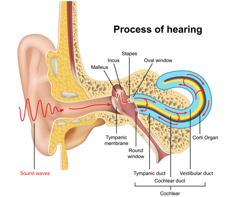 What is Low Frequency Hearing Loss? AudioCardio Sound Therapy