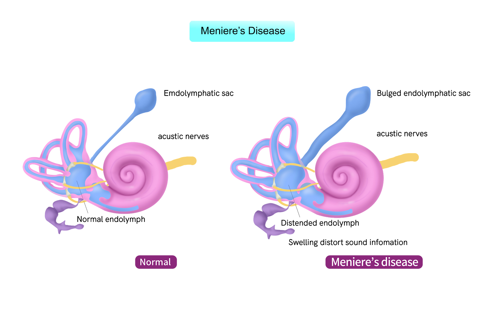 Uncategorized AudioCardio Sound Therapy