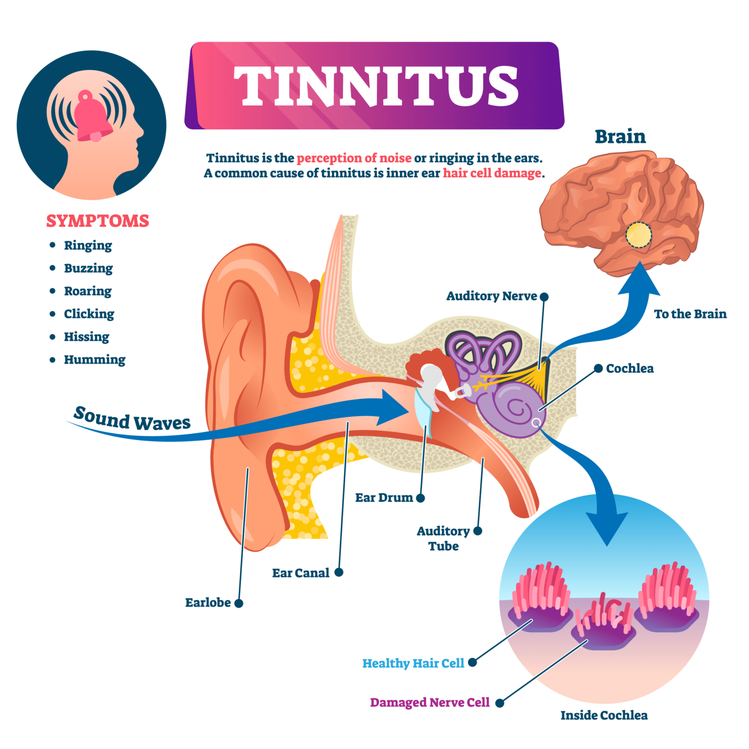 does-covid-19-make-tinnitus-worse-audiocardio-sound-therapy